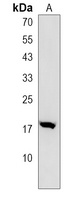 COX6A2 Rabbit Polyclonal Antibody