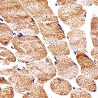 COX6A2 Rabbit Polyclonal Antibody