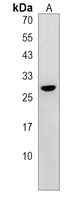 NUCKS1 Antibody