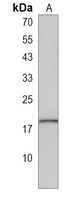 AGR3 Rabbit Polyclonal Antibody