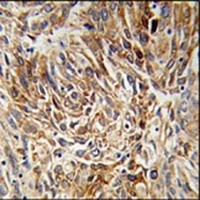 AGR3 Rabbit Polyclonal Antibody