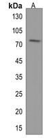 DDX17 Rabbit Polyclonal Antibody