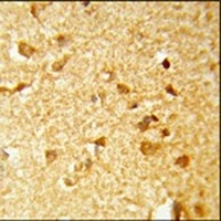 DDX17 Rabbit Polyclonal Antibody