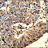 TSPEAR Rabbit Polyclonal Antibody