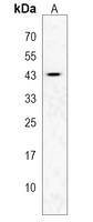 KCTD12 Rabbit Polyclonal Antibody