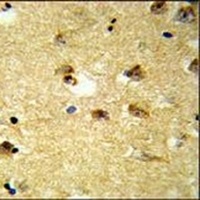 KCTD12 Rabbit Polyclonal Antibody