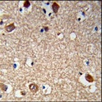 ACTR5 Antibody