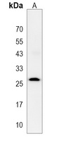 TSPAN6 Rabbit Polyclonal Antibody