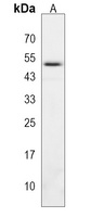 ADH6 Rabbit Polyclonal Antibody