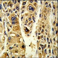 ADH6 Rabbit Polyclonal Antibody
