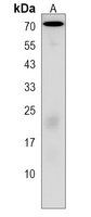 FBXO3 Rabbit Polyclonal Antibody