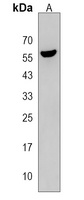 CDC14B Rabbit Polyclonal Antibody
