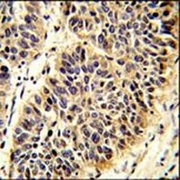 RABAC1 Rabbit Polyclonal Antibody