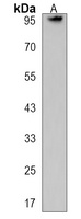 DZIP1 Rabbit Polyclonal Antibody