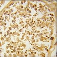 DZIP1 Rabbit Polyclonal Antibody