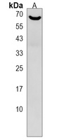 DTX1 Rabbit Polyclonal Antibody