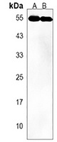 UBAP1 Rabbit Polyclonal Antibody
