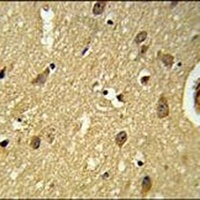 UBAP1 Rabbit Polyclonal Antibody