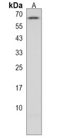 CTPS2 Rabbit Polyclonal Antibody