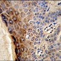 CTHRC1 Antibody