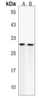 DIO2 Rabbit Polyclonal Antibody