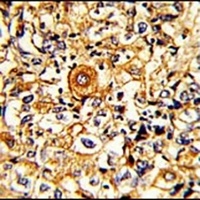 PTAR1 Rabbit Polyclonal Antibody