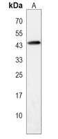 CECR5 Rabbit Polyclonal Antibody