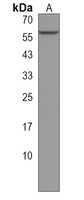 PFKFB1 Rabbit Polyclonal Antibody