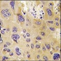 PFKFB1 Rabbit Polyclonal Antibody