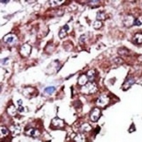 NME7 Rabbit Polyclonal Antibody
