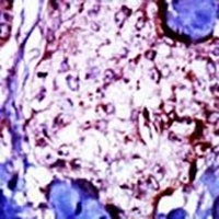 NME5 Antibody