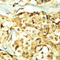 TNIK Rabbit Polyclonal Antibody