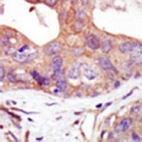 PKN2 Rabbit Polyclonal Antibody