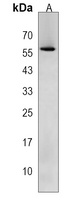 Cytochrome P450 4A11 Rabbit Polyclonal Antibody