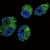 Cytochrome P450 4A11 Rabbit Polyclonal Antibody