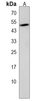 SRMS Rabbit Polyclonal Antibody