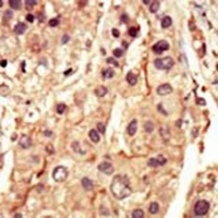 SRMS Rabbit Polyclonal Antibody