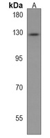 ACK1 Rabbit Polyclonal Antibody