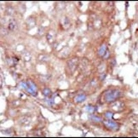 ACK1 Rabbit Polyclonal Antibody