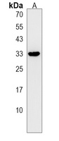 MPST Rabbit Polyclonal Antibody