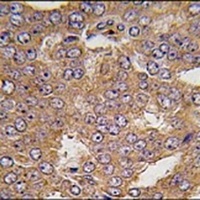 NARS2 Rabbit Polyclonal Antibody