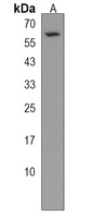 CDK17 Rabbit Polyclonal Antibody