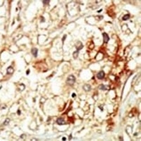 CDK17 Rabbit Polyclonal Antibody