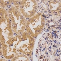 HIPK3 Antibody