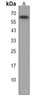 DYRK3 Rabbit Polyclonal Antibody
