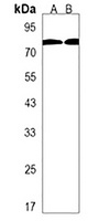 DDX53 Rabbit Polyclonal Antibody