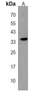 HMX2 Rabbit Polyclonal Antibody