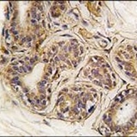 CASC3 Rabbit Polyclonal Antibody