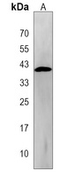 PANK3 Rabbit Polyclonal Antibody