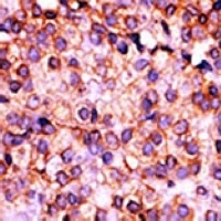 PANK3 Rabbit Polyclonal Antibody
